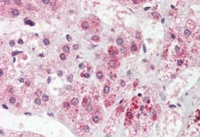 Immunohistochemistry-Paraffin: NEK9 Antibody [NBP3-14416] - Immunohistochemistry of formalin-fixed, paraffin-embedded human adrenal after heat-induced antigen retrieval.